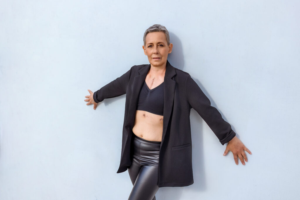 Woman with short gray hair, wearing black blazer, top, and pants, leans against a light blue wall. Visible scars on her ch...